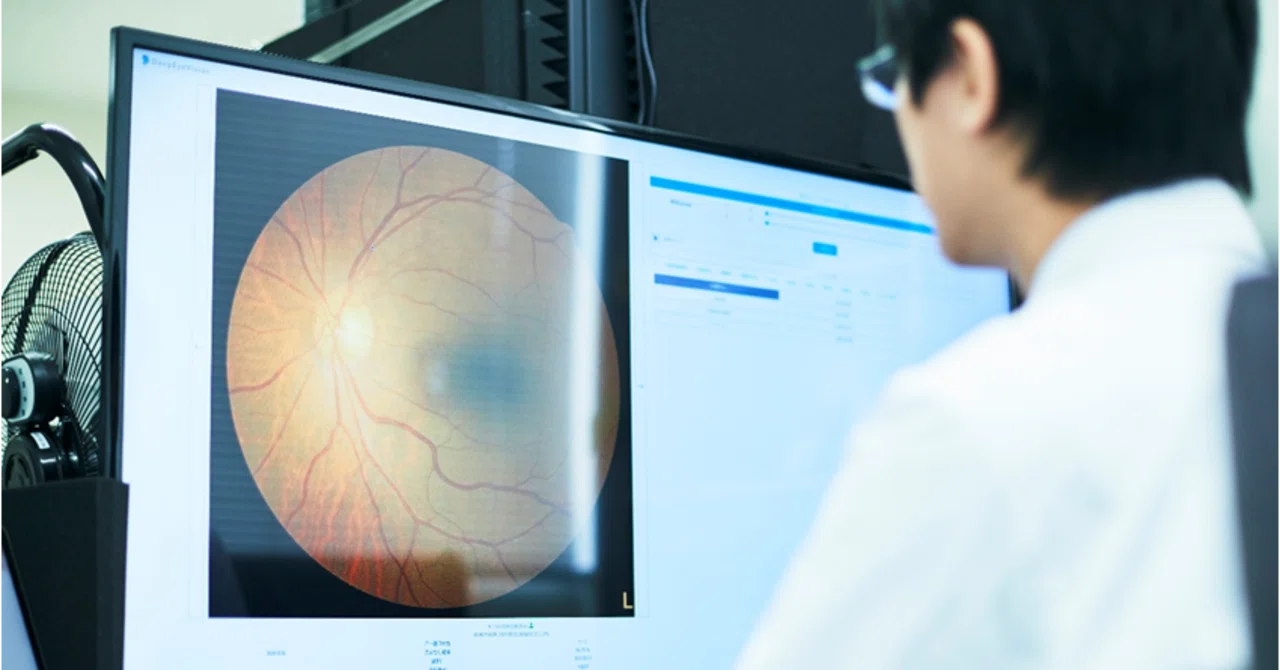 なぜAIは“別の病院”で使えなくなるのか？緑内障診断AIの「汎用化」という壁